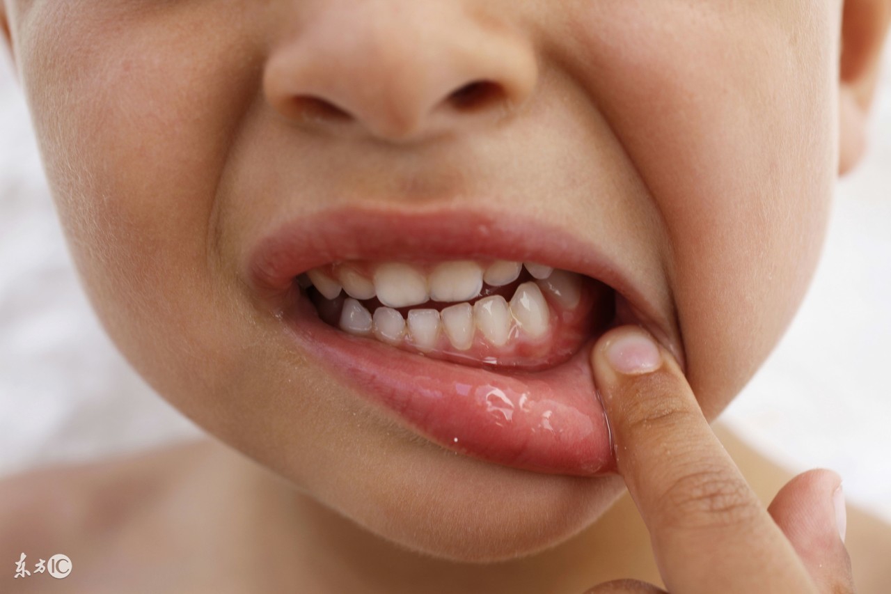 牙疼止疼小妙招简单一招解决,牙疼止疼的最有效的方法