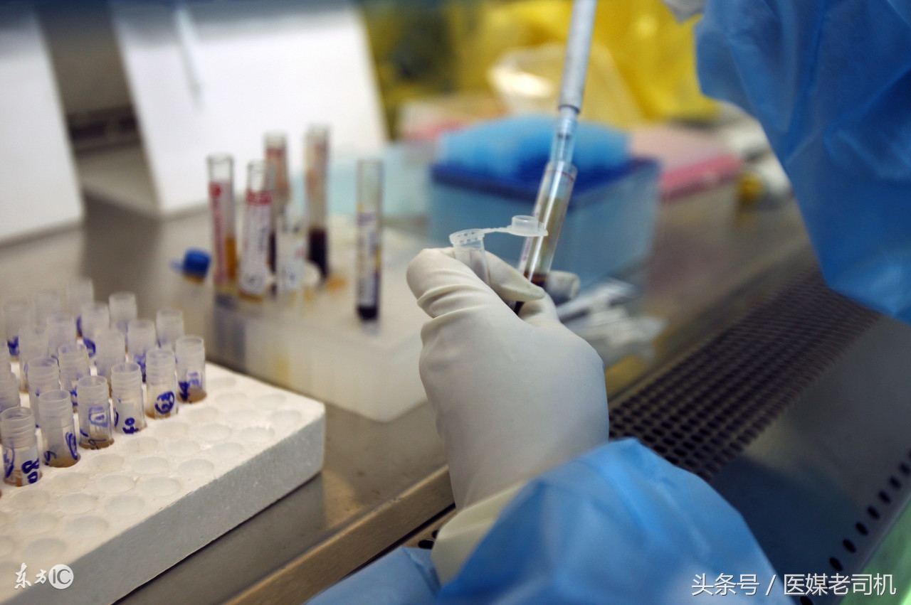 别用噱头制造恐慌！评新京报《协和发现国内首例阴性艾滋病患者》