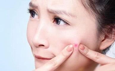 长痘的人到底有多惨如何正确祛痘,祛痘痘最好最实际的方法