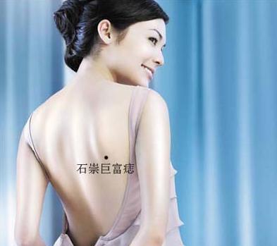 六大富贵痣你有几个,五个地方长痣是富贵痣