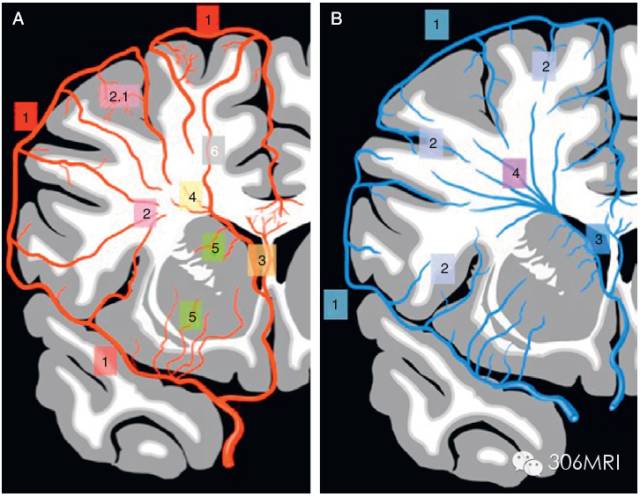 核磁共振轻度脑白质征象,脑白质内见多发斑点什么状况