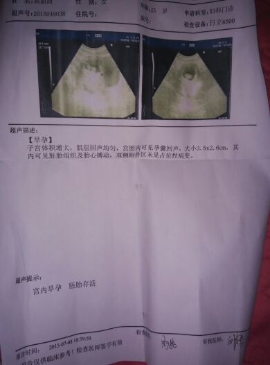 宝妈分享怀宝宝的症状,怀了女宝初期感受