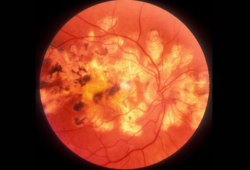 你都不知道这些检查有多可怕,别再被骗了这7个检查不需要做