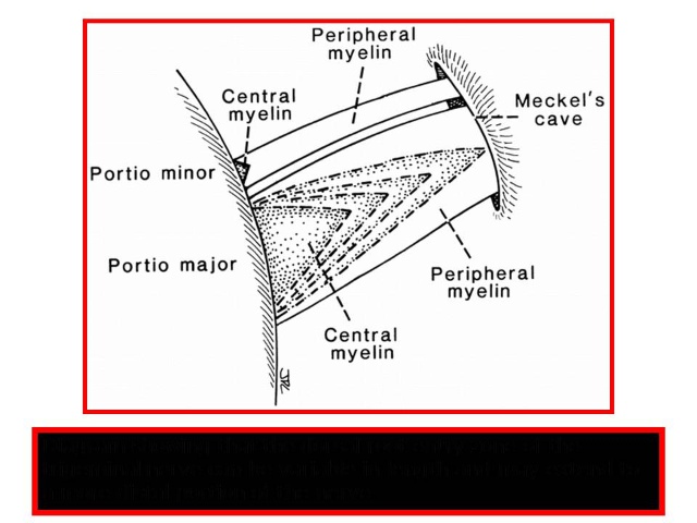 三叉神经痛和继发性的三叉神经痛,三叉神经贴治疗三叉神经痛的原理
