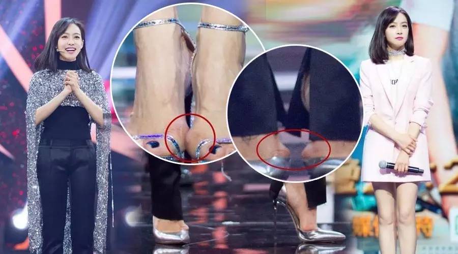 杨丞琳用黑绷带,杨丞琳安慰粉丝视频