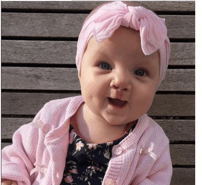 怀孕5个月了查出宝宝兔唇,孕妈没有按时产检娃有兔唇