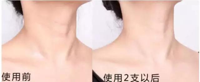 王丽坤范冰冰,王丽坤baby推荐面膜