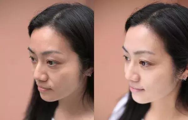 王丽坤范冰冰,王丽坤baby推荐面膜