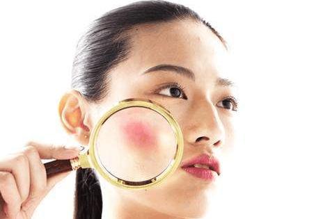 脸上激素依赖性皮炎正确治疗方法,激素依赖性皮炎有哪些忌口