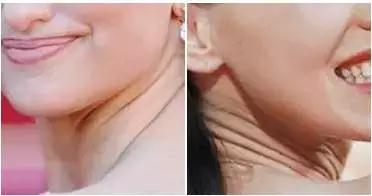 王丽坤范冰冰,王丽坤baby推荐面膜