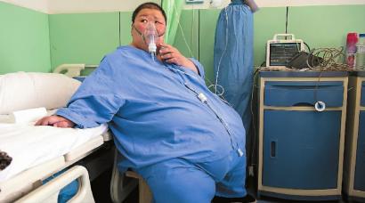 体重指数87接近正常人四倍188.9公斤的他减重手术告捷