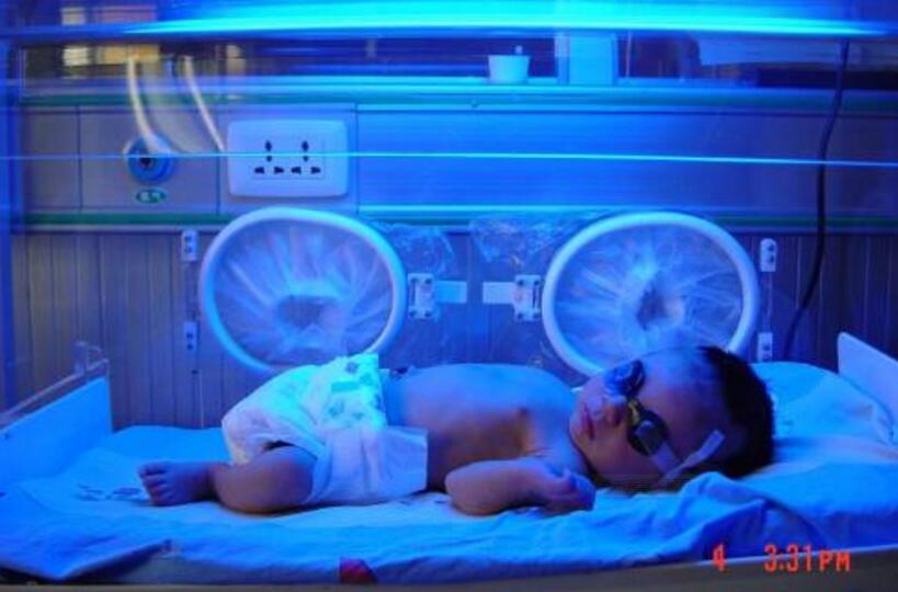 孕妇abo溶血有什么注意的,怀孕溶血是什么血型才会发生的