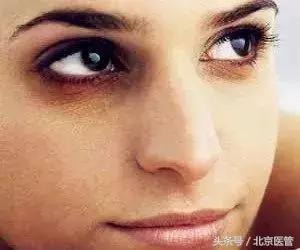 眼部化妆缓解浮肿,如何简单护理眼周细纹