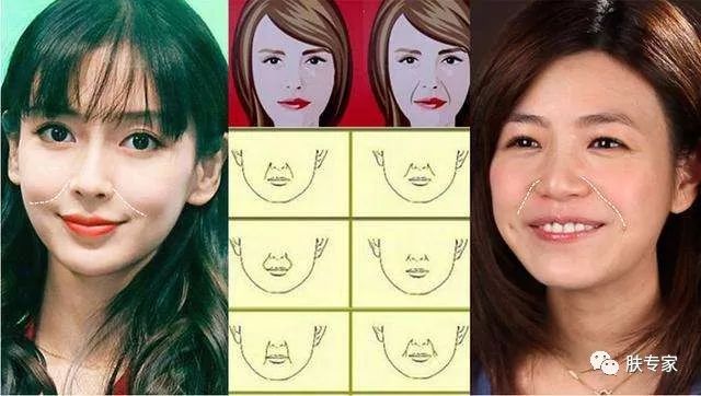 法令纹能够通过护肤品改善吗,有护肤手法真的能淡化法令纹吗