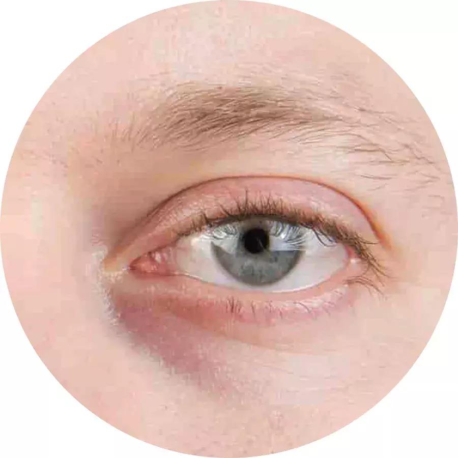 眼霜也要到年纪了才用,眼霜多大岁数合适用