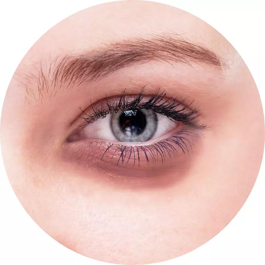 眼霜也要到年纪了才用,眼霜多大岁数合适用