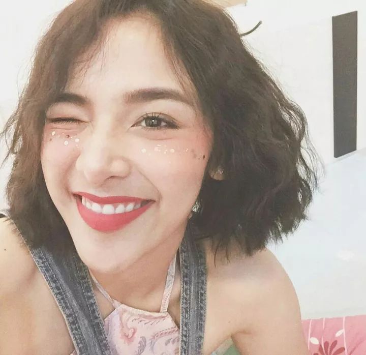 玻尿酸是瘦脸还是填充,玻尿酸填充脸颊会有提拉效果吗