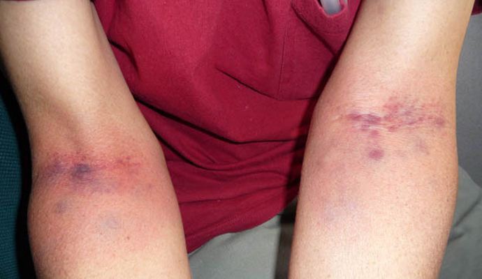 你爱上火吗？快吃这些美味蔬果吧，吃着吃着就灭火啦