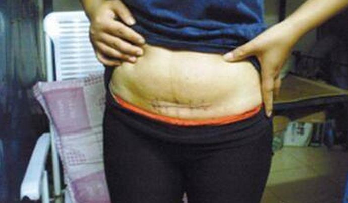 女子带环两年怎么突然怀孕了,女人带环有小孩能够要吗