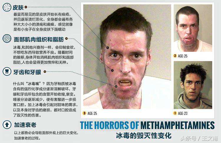 吸毒后的经历,吸毒一年后真的很可怕吗