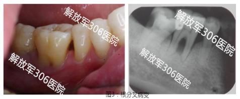 科普牙周小知识,牙周基础知识大全