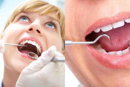 牙根发炎牙齿松动怎么治疗,牙根发炎什么原因造成