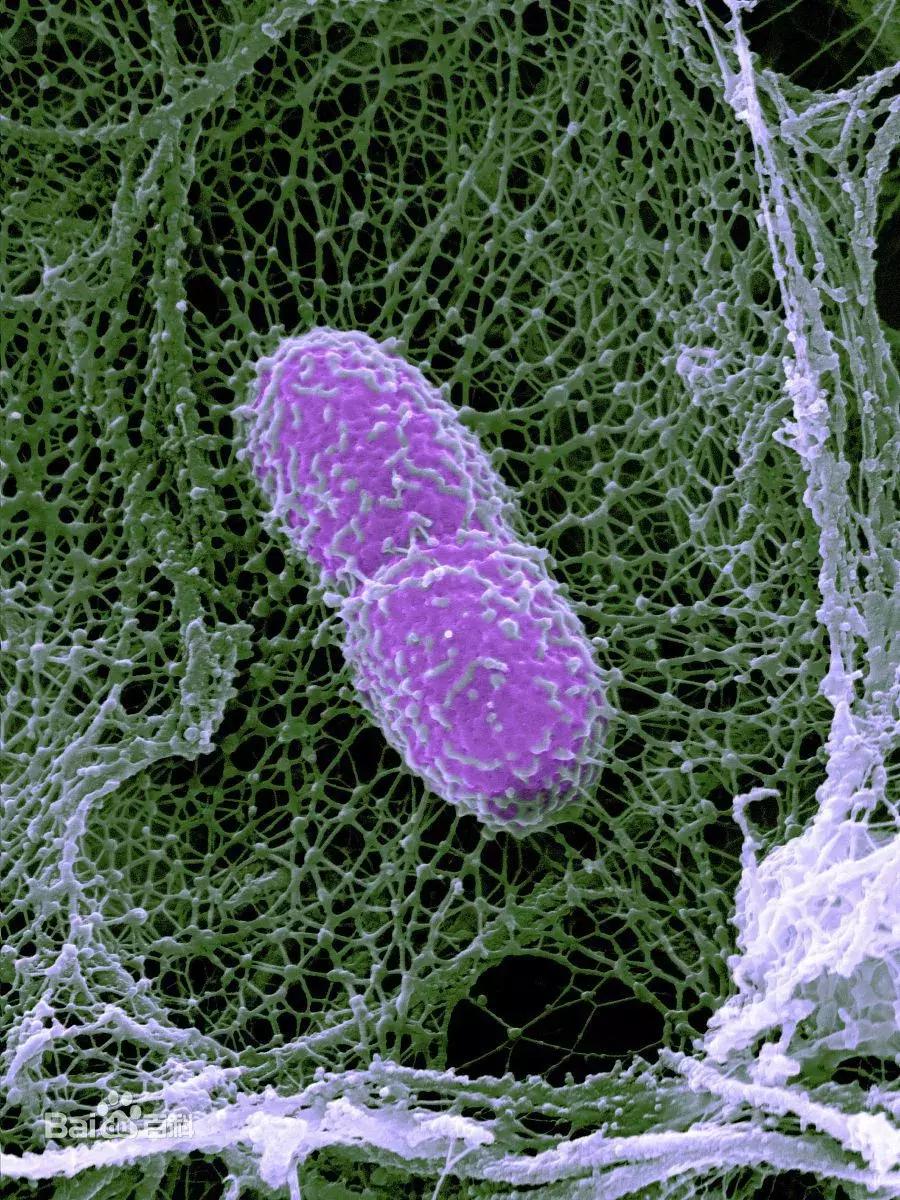 菌从口入，可导致肠胃炎