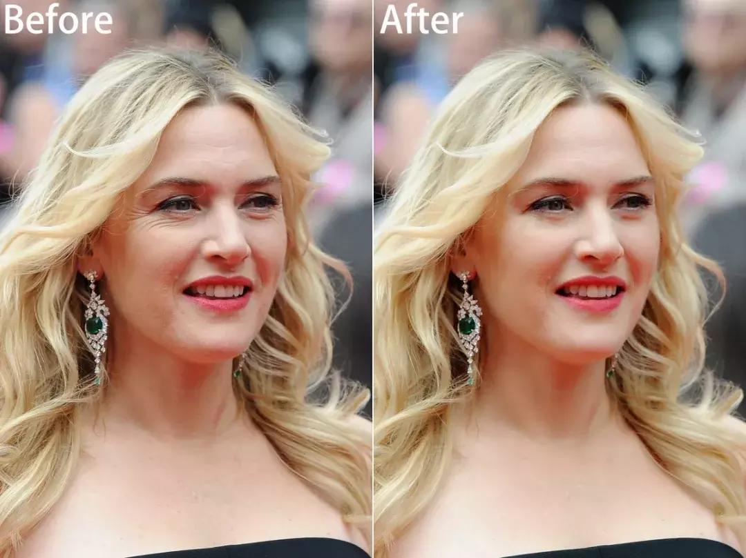 27岁有细纹黑眼圈用什么眼部护理,黑眼圈细纹浮肿补水