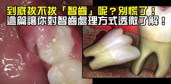 智齿长歪了把邻牙挤坏了,智齿挤歪了会自己恢复吗