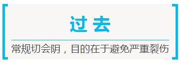 生孩子，你需要做会阴侧切么？