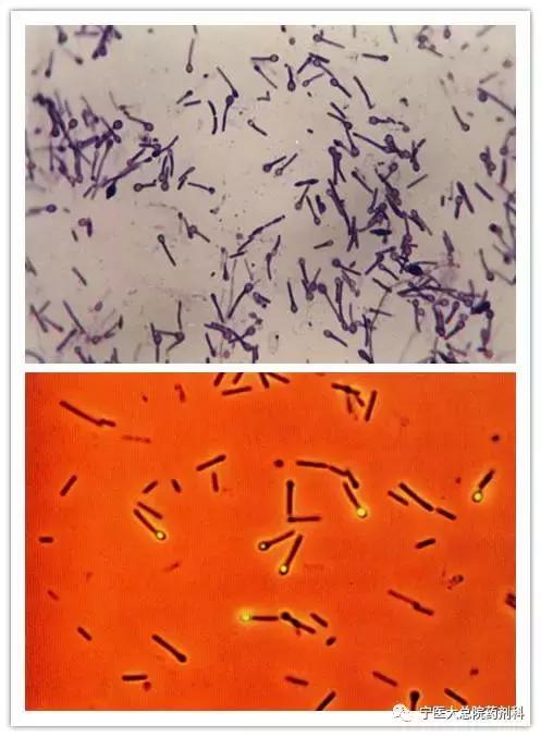 苦笑面容破伤风,破伤风苦笑面容能够治愈吗