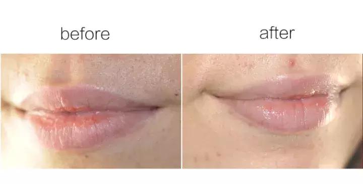 冬季嘴唇干燥起皮用什么唇膏好,十大好用冬季润唇膏排行榜