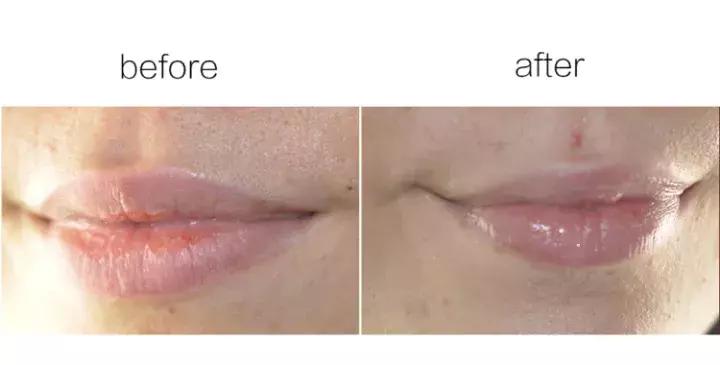 冬季嘴唇干燥起皮用什么唇膏好,十大好用冬季润唇膏排行榜