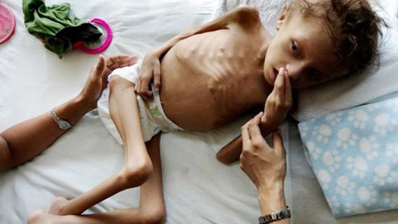 女性容易掉头发的原因及解决方法,女性掉很多头发是什么原因引起的