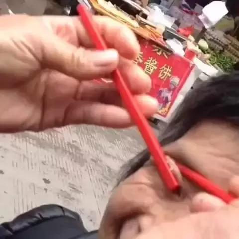 路边上有人抓眼虫是真的吗,用筷子真能够捉眼虫吗