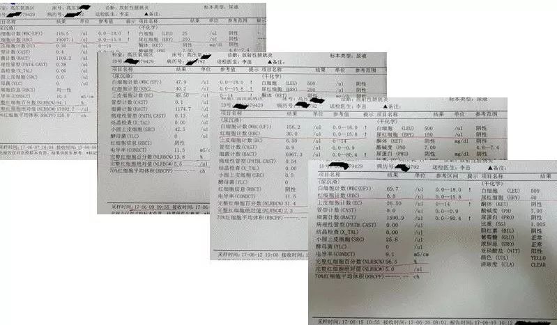 高压氧舱治疗膀胱炎尿血吗,高压氧对慢性肾病有功能吗