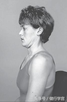 颈椎病的康复治疗手法,颈椎病用圆枕能康复吗