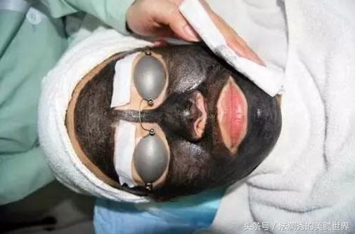 医美如何祛痘坑和痘印,医美护肤小知识问答祛痘