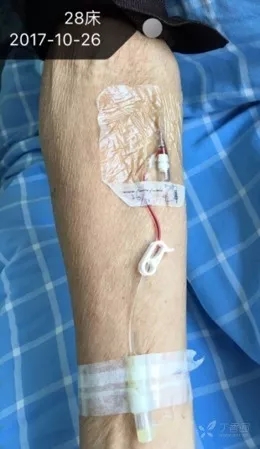 套管针的使用方法和保存方法,怎么让套管针回血