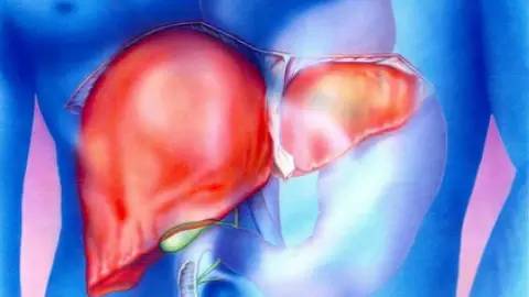 孕妇脂肪肝一般好久能够出院,孕妇脂肪肝吃什么食物好呢