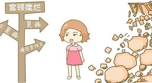 女士宫颈糜烂好不好治,揭秘宫颈糜烂的致命杀手