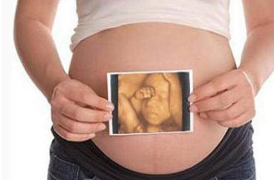 四维彩超预测宝宝长相项目,四维彩超能够看到小孩样子吗