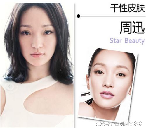 皮肤测试皮肤健康了解皮肤类型,皮肤的分类及皮肤的分析方法