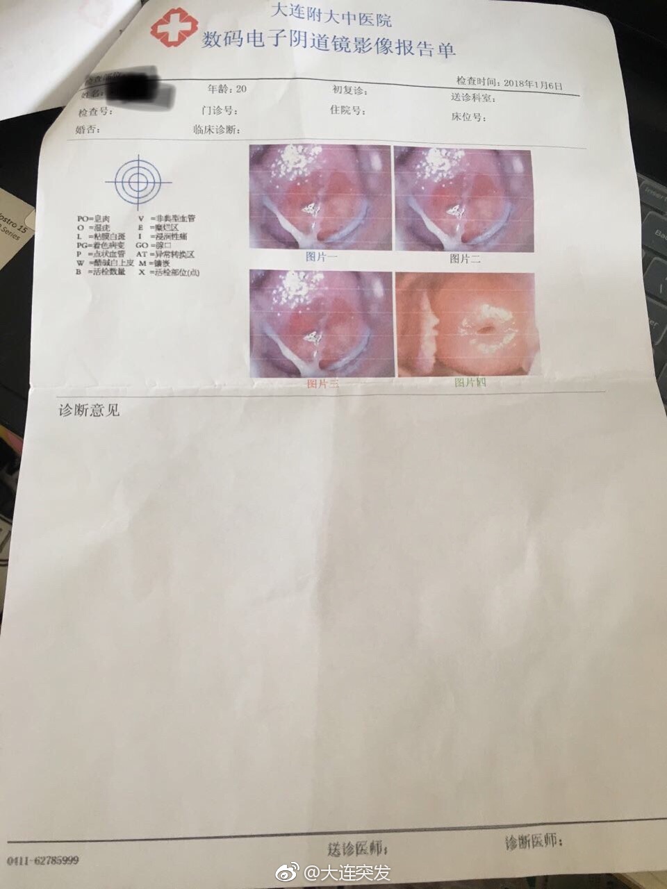 做一次妇检需要多少钱,做个妇科检查花了两千多