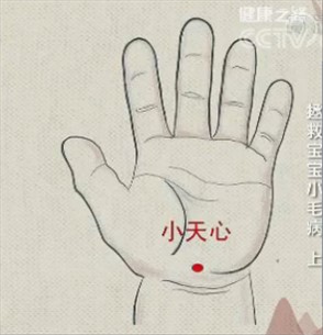 孩子话多注意力不集中是多动症,小孩子注意力不集中中医怎么解决