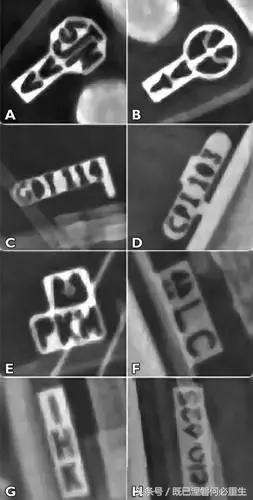 心内除颤仪和起搏器有什么区别,起搏器除颤仪