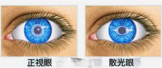 弱视行家王大夫,王大夫小儿微针疗法视频