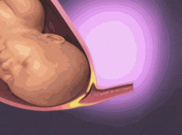 生孩子产程过长,生孩子顺产全产程最快要多久