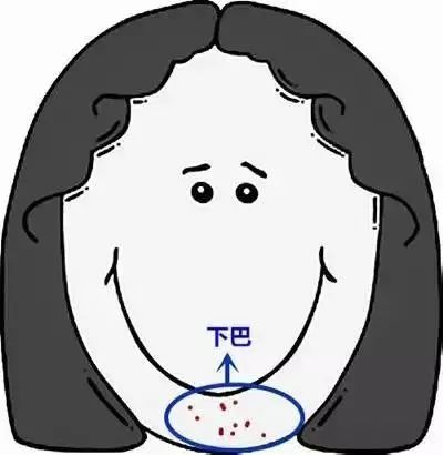 郑爽屏幕前貌美如花，幕后满脸痘花，明星都被坑的痘痘该怎么治？