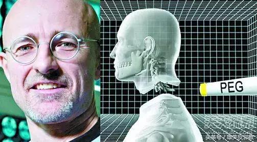 关于换头的看法,如果换头告捷了会怎么样